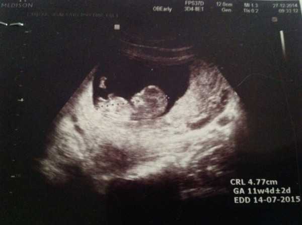 27 неделя беременнои рост и развитие малыша