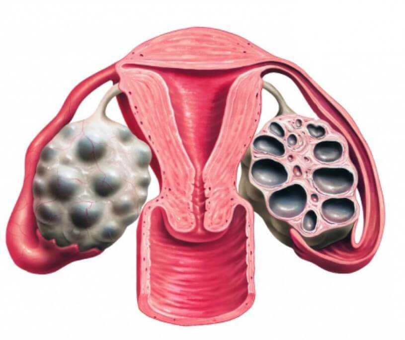 14 способов не забеременеть: гид по контрацепции