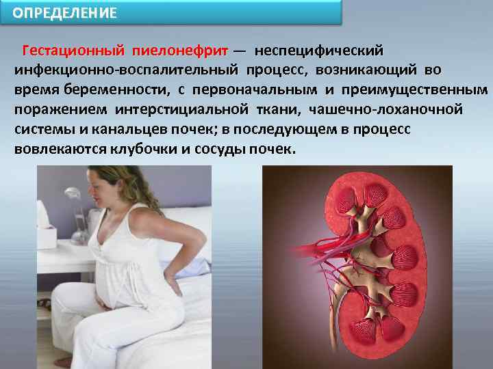 Инфекция мочевыводящих путей (имвп) у беременных