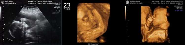 10 недель беременности описание и фото — евромедклиник
