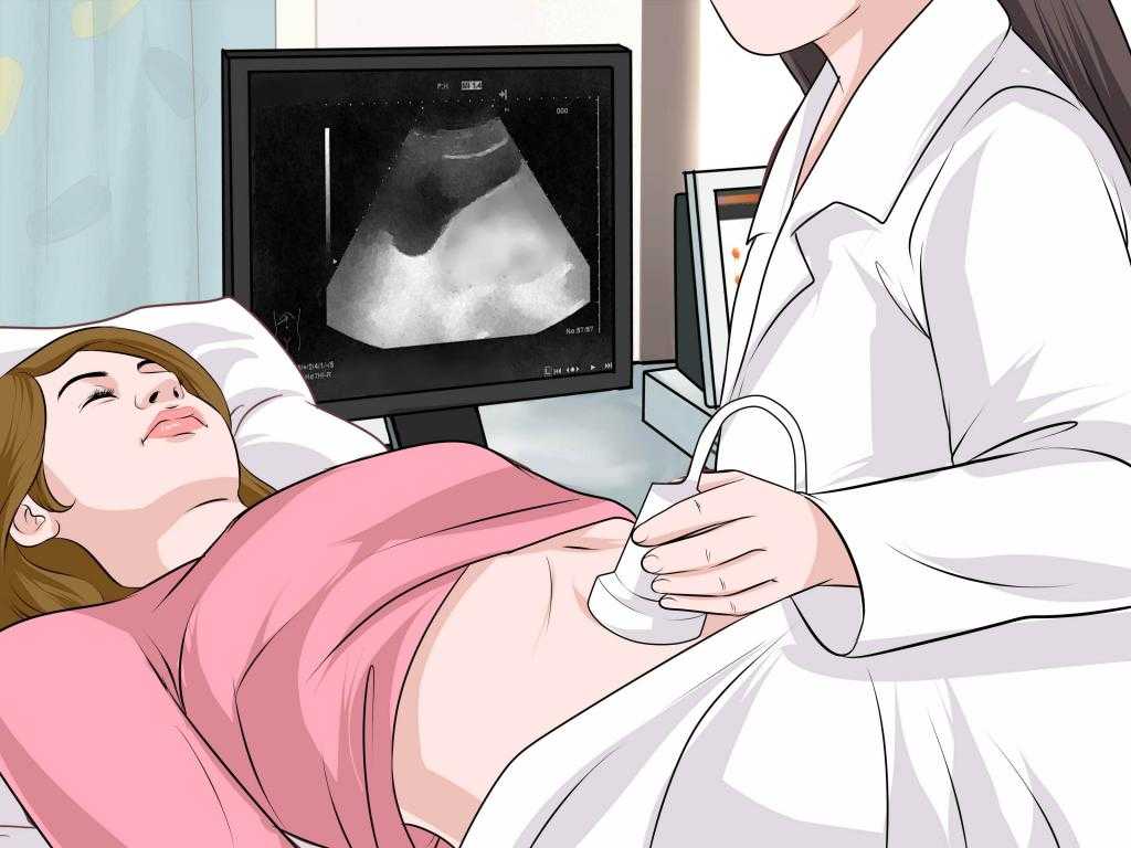Внематочная беременность: у кого чаще всего развивается и как лечится
