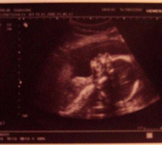 5 проверенных признаков беременности мальчиком