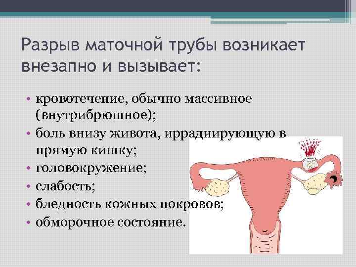 Преждевременные роды, угроза прерывания беременности | клиника ведения беременности