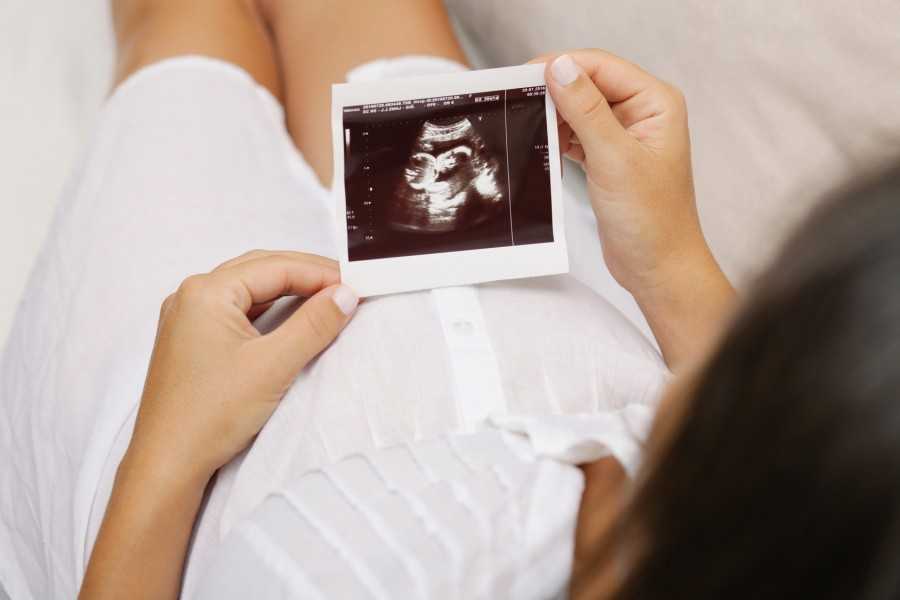 Узи при беременности: как часто можно делать, вредно ли это, расшифровка