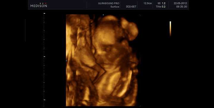 23 неделя беременности развитие и фото — евромедклиник