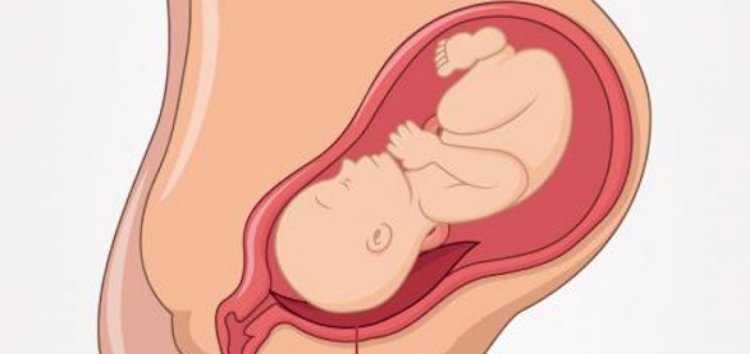 Предлежание плаценты при беременности