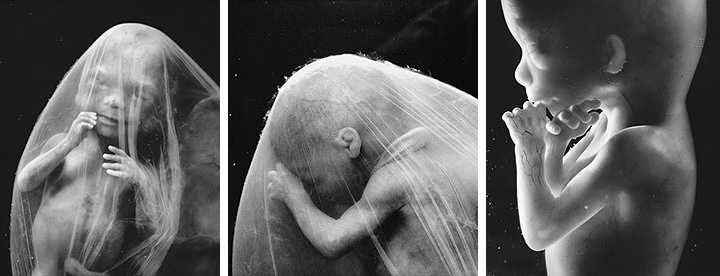 19 неделя беременности: что происходит, фото живота ожидающих девочек