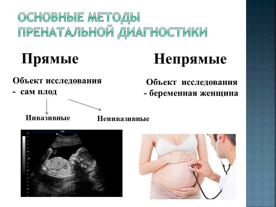 Скрининг 2 триместра беременности