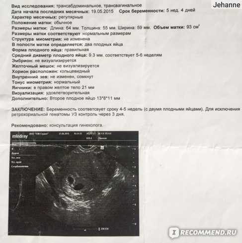 32 неделя беременности: развитие ребенка | pampers ru