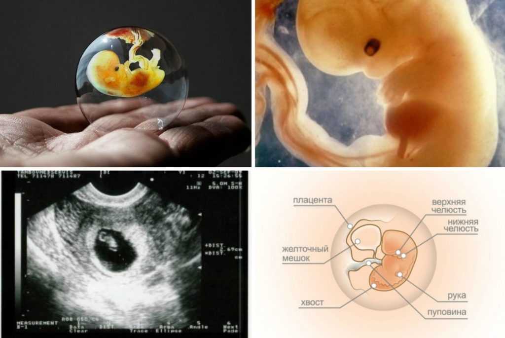 32 неделя беременности развитие и фото — евромедклиник