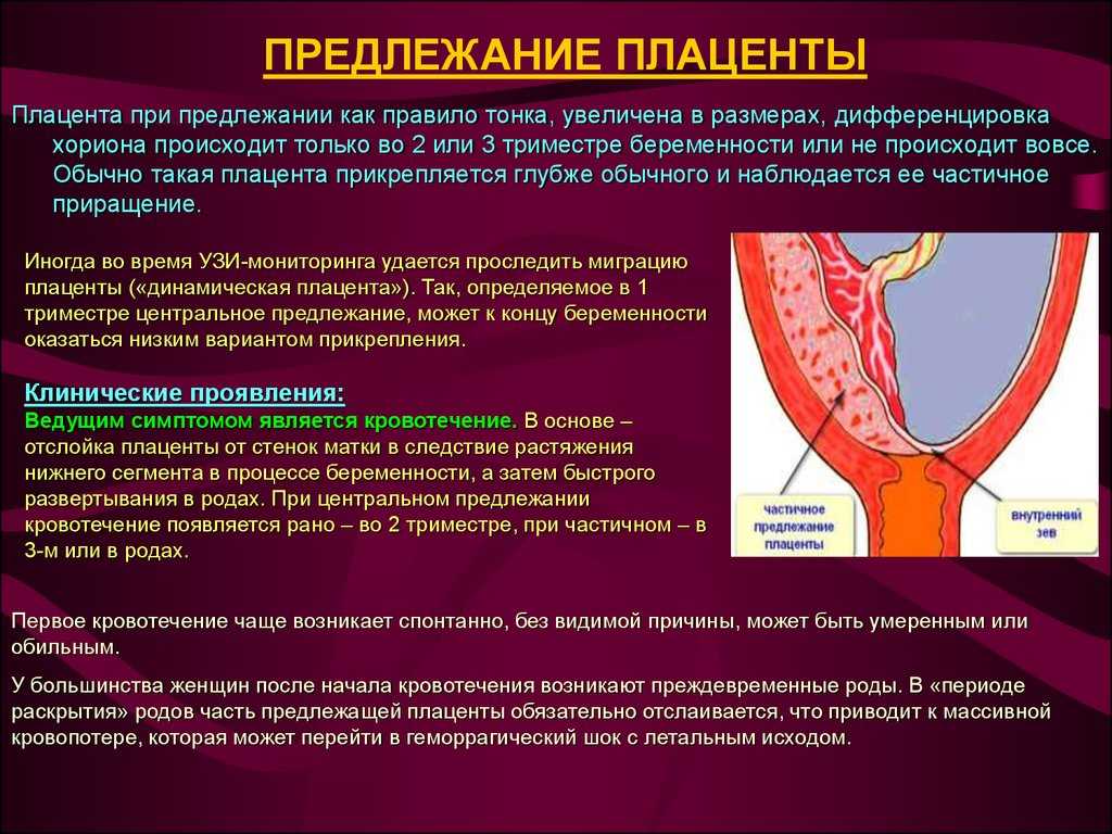 Плацента по передней стенке – что это значит, как еще может быть расположен орган в матке?