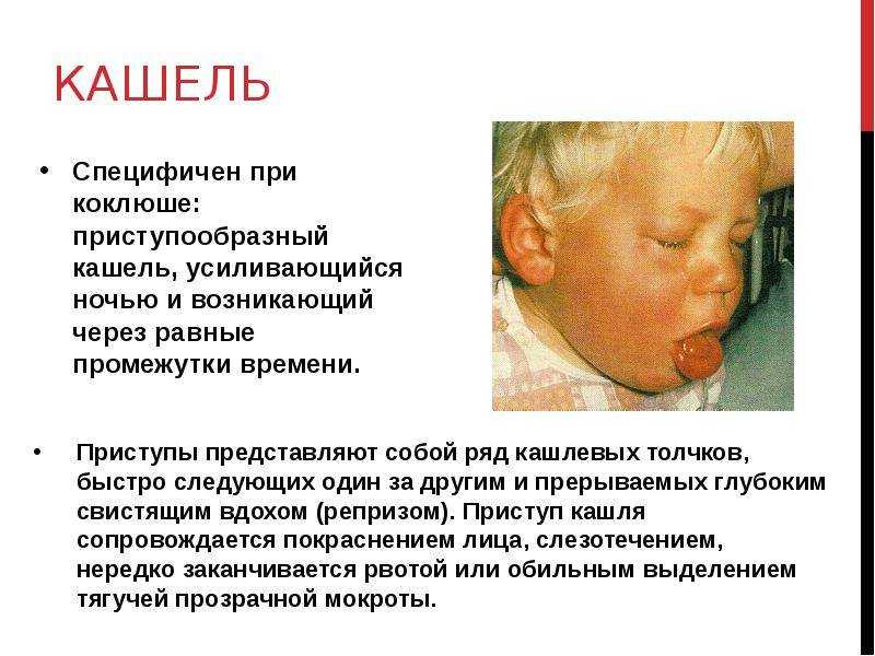 Вакцинация беременных против коклюша