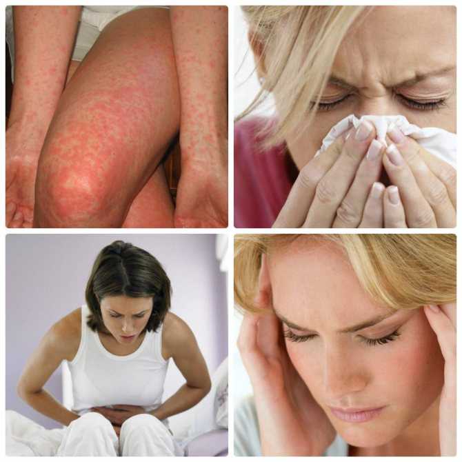 Пищевая аллергия - причины, симптомы, лечение | фитомуцил сорбент форте