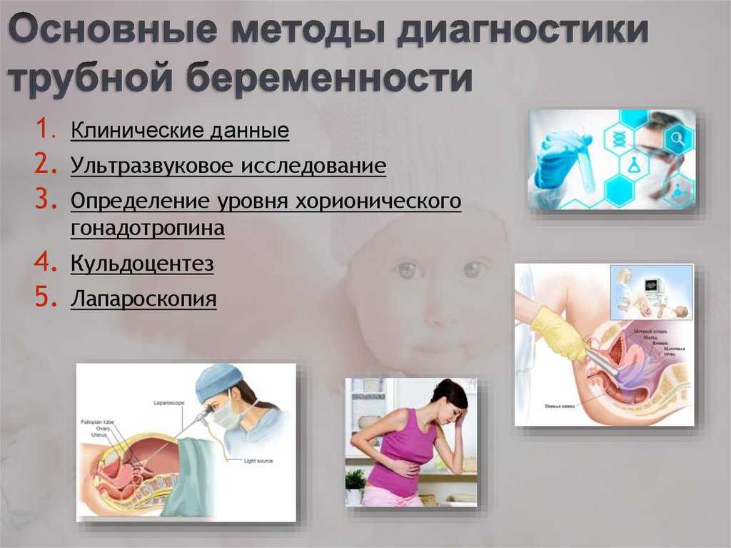 Внематочная беременность - признаки, причины, симптомы, лечение и профилактика
