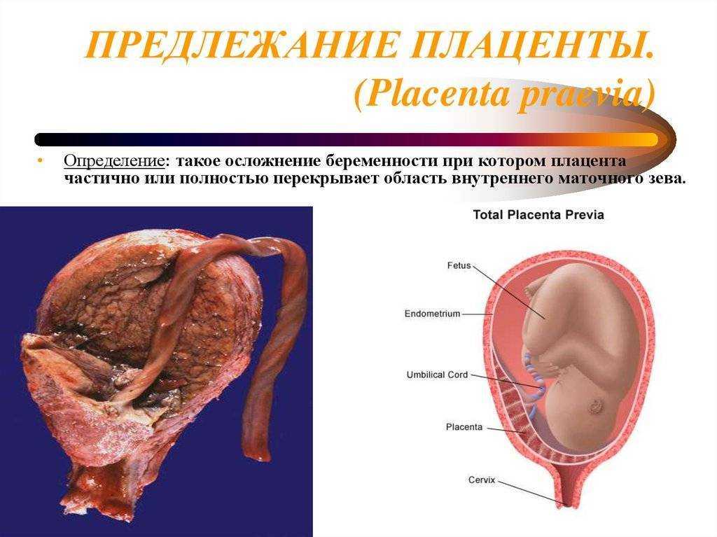 плацента по передней стенке, плацента по передней стенке фото, плацента по передней стенке и шевеления, степень зрелости плаценты, плацента по передней стенке выше внутреннего зева, плацента по передней стенке низко, толщина плаценты, плацента по задней с