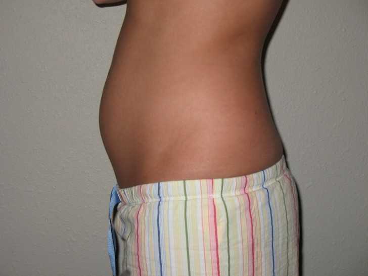 Новая беременность может стать основанием для получения пособия на ребенка — иа «версия-саратов»