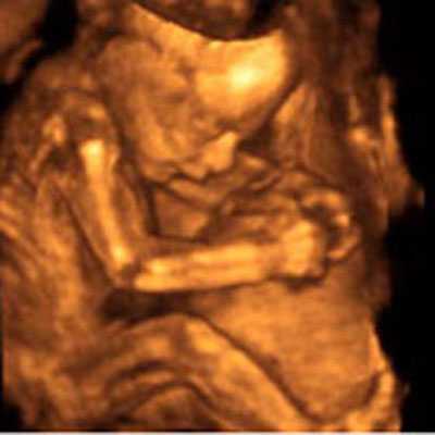 23 неделя беременности: фото, животик, узи, ощущения