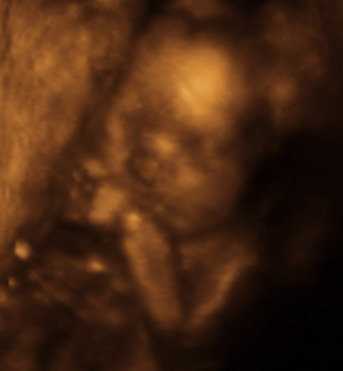 15 неделя беременности развитие и фото плода