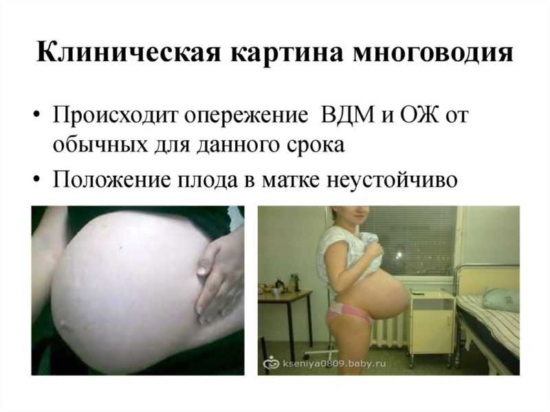 Многоводие и маловодие при беременности: симптомы и лечение | курсы и тренинги от лары серебрянской