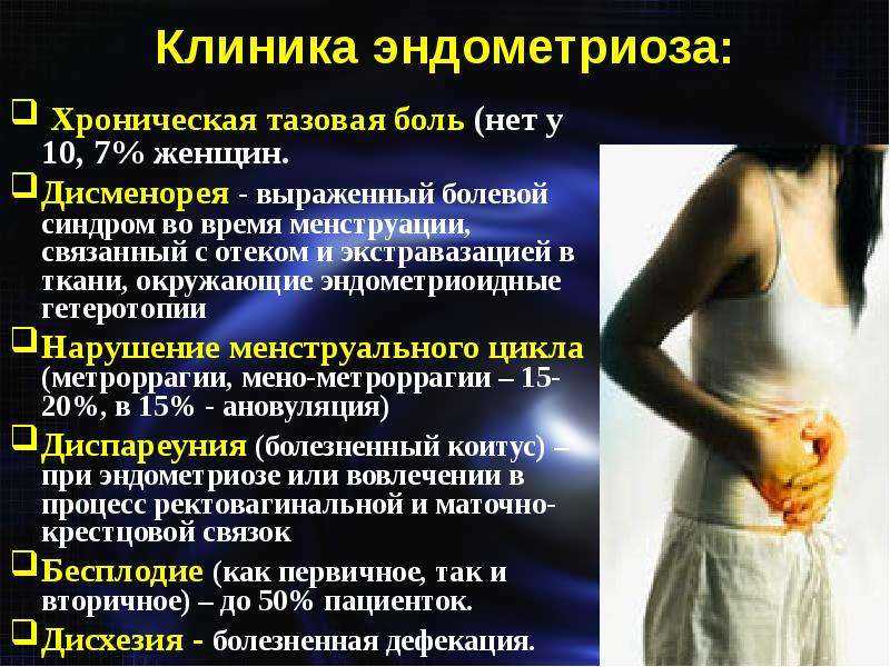 Эндометриоз, лечение эндометриоза у женщин срочно от 1800 руб
