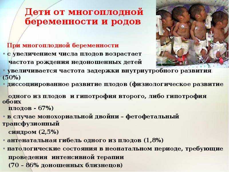 Сиамские близнецы (сросшиеся дети) - кто это, фото, разделенные, в россии, самые известные, видео