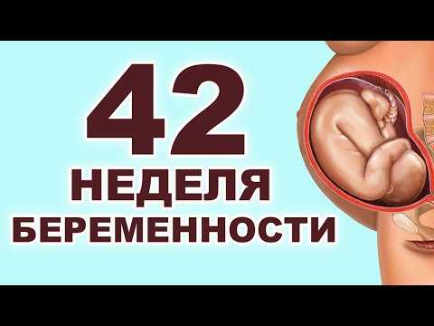 42 недели беременности, роды не начинаются: что делать? :: syl.ru