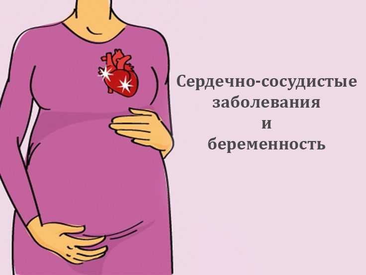 Беременность и сердечно-сосудистые заболевания