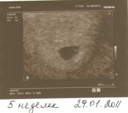 6 неделя беременности: развитие плода | pampers ru