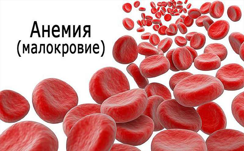 Низкий гемоглобин при онкологии: прогноз, лечение, симптомы в международной клинике медика24