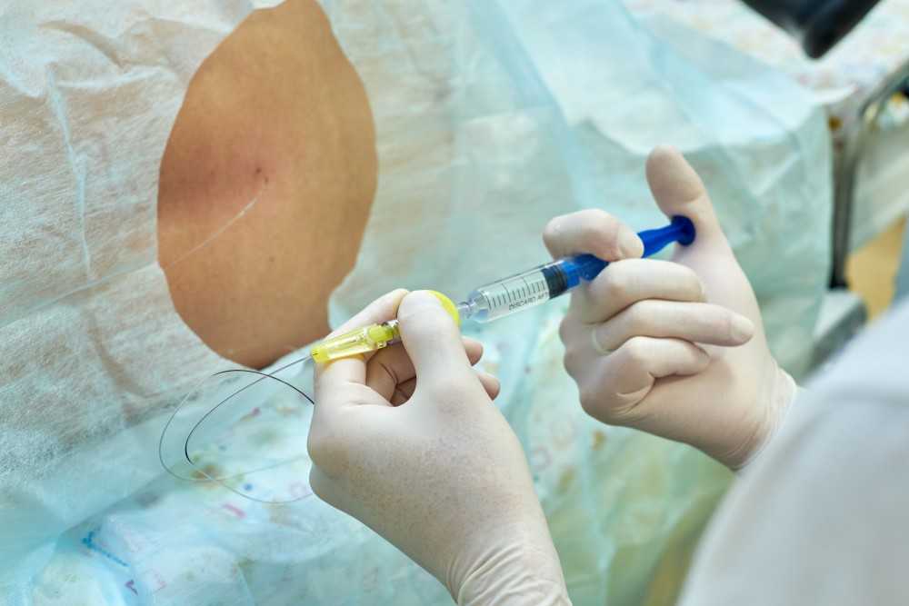 Спинальная и эпидуральная анестезия при кесаревом сечении: отзывы, восстановление, последствия для мамы и противопоказания