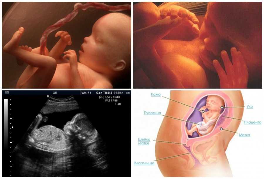22 неделя беременности фото плода и ощущения — евромедклиник