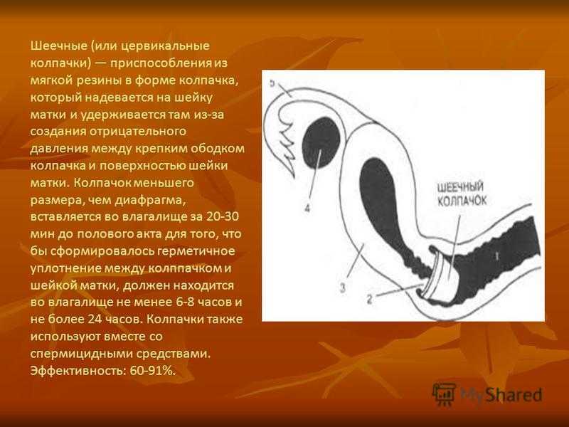 Цервикальный метод контрацепции - метод цервикальной слизи, метод биллингса