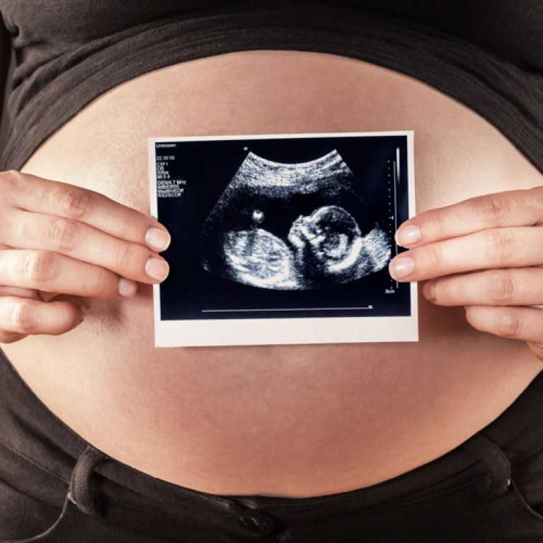  18 неделя беременности - ощущения и фото 