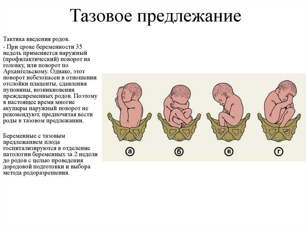 Фото животиков беременных на 28 неделе беременности