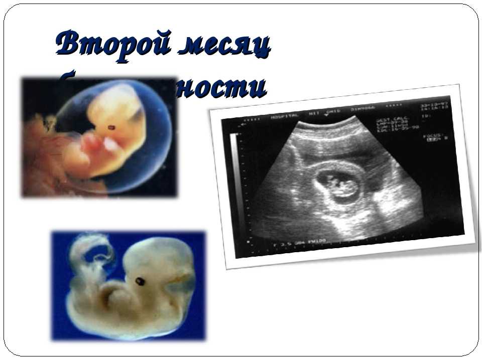 Этапы развития плода — 2 месяц — медицинский женский центр в москве
