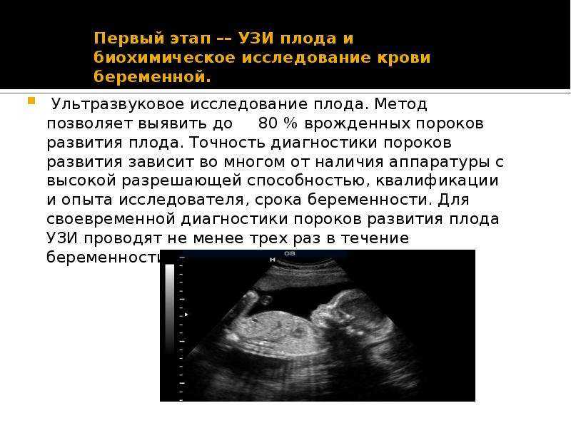 Неразвивающаяся  беременность - симптомы болезни, профилактика и лечение неразвивающейся беременности, причины заболевания и его диагностика на eurolab