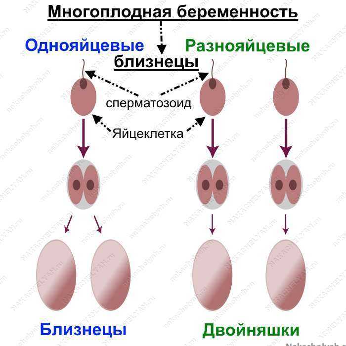 Роды двойни: естественные или кесарево сечение | как проходят роды двойни