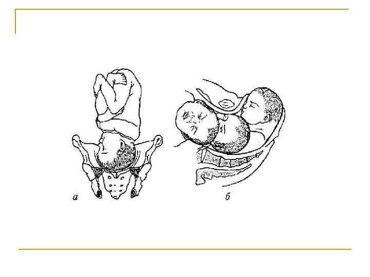Формы живота при беременности девочкой и мальчиком (фото)