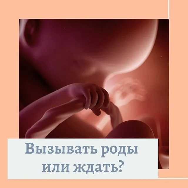 41-я неделя беременности - родить или погодить? - беременность