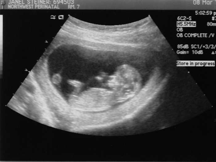 9 неделя беременности: что происходит в 3 месяц от зачатия?