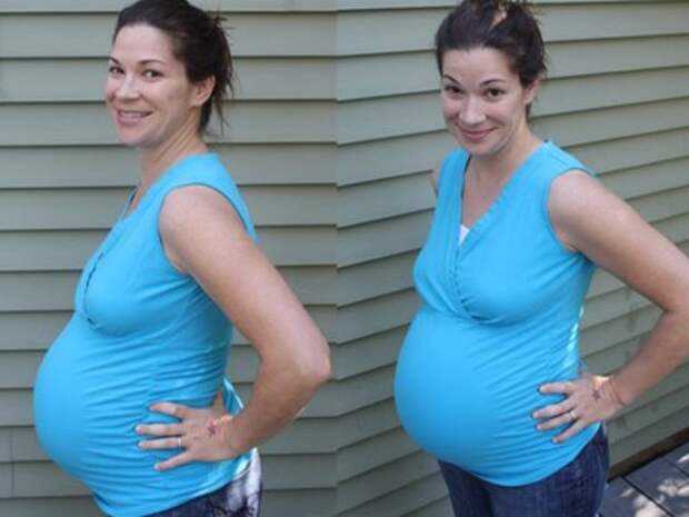 Что показывает узи у беременных двойней