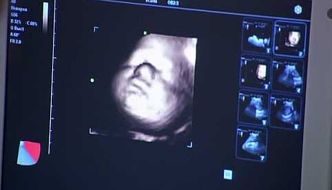Коронавирус и беременность. интервью с врачом-гинекологом-репродуктологом