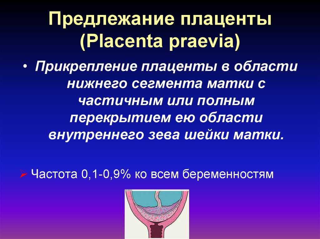 «лежачая» беременность – причины и последствия