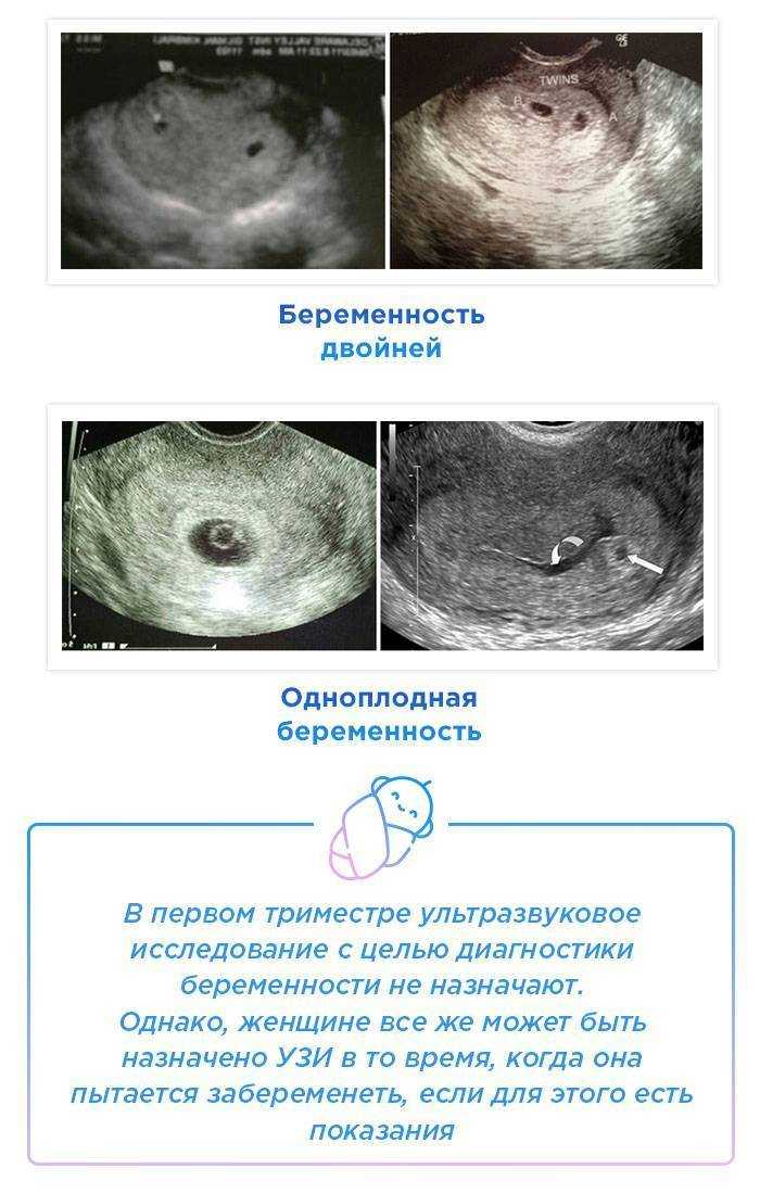 Беременность по неделям: от ощущений до развитие плода по неделям