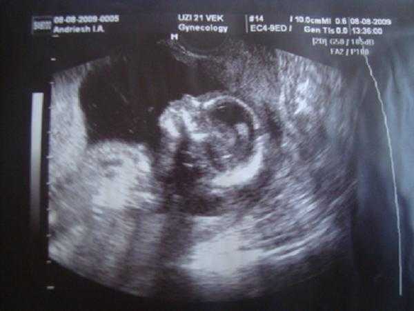 Ребенок в 15 недель беременности фото и описание