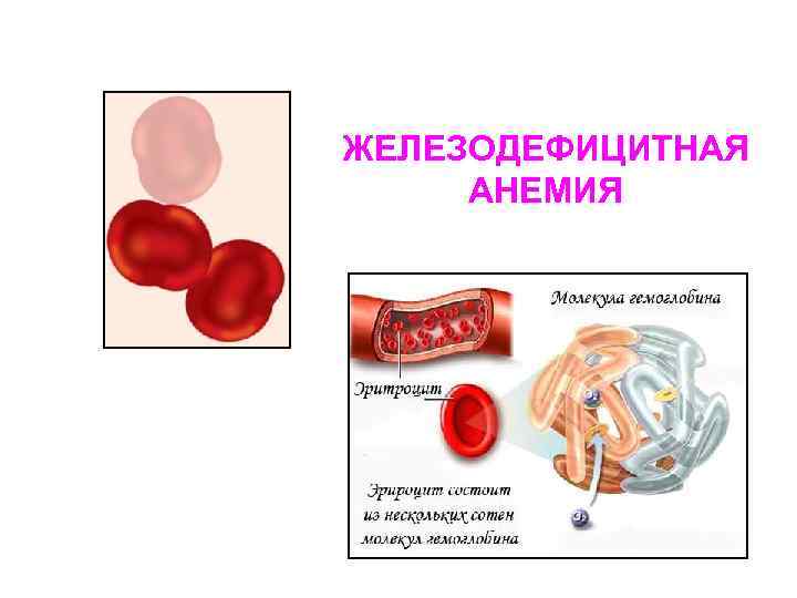 Анемия мышцы