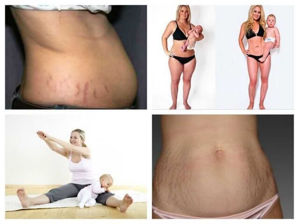 Как похудеть после родов - маевская евгения андреевна
