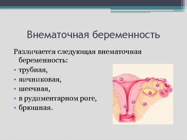 Глава 18. внематочная беременность