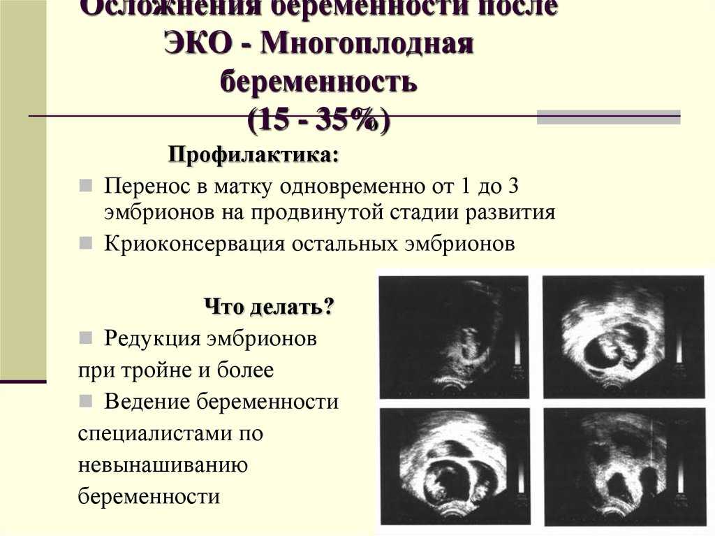 Центильные номограммы для оценки массы и длины новорожденных при многоплодной беременности