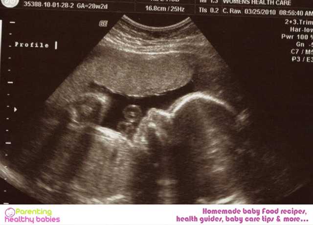 23 неделя беременности развитие и фото — евромедклиник